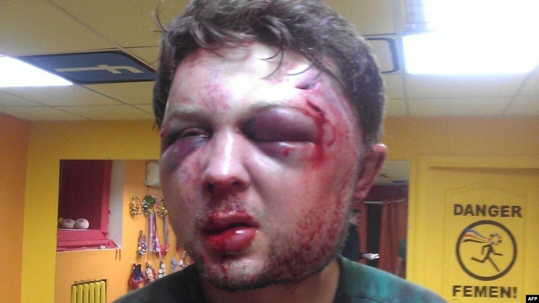 Femen said the assailants broke Viktor Svyatskiy's jaw and knocked out several of his teeth and that he was taken to a hospital for treatment.