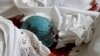 Kyiv's Hotel Ukraine Becomes Makeshift Morgue 