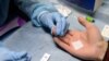 No HIV Test? No Wedding In Russia's Ingushetia